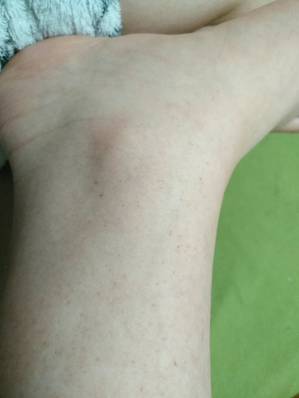 脚上莫名长了好多小红点 有人知道这是什么吗 刚洗完澡脚面上会有 脚