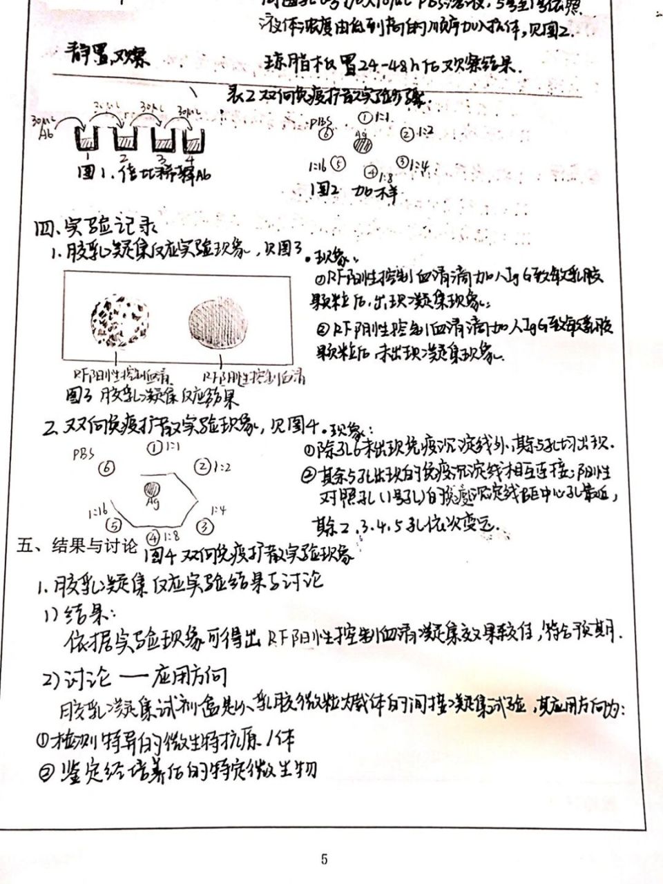 免疫学实验报告--凝结和双扩 #医学生笔记# #医学生# #医学# #实验