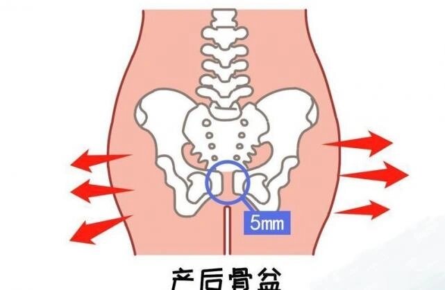 耻骨分离又叫耻骨联合分离症是指骨盆前方两侧耻骨纤维软骨联合处,因