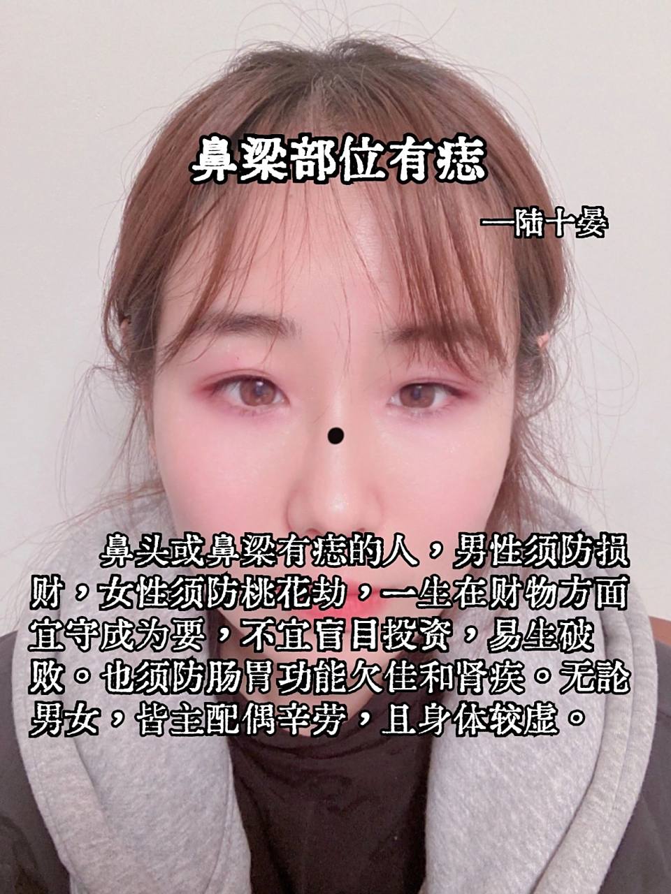 鼻梁有痣是什么意思 鼻梁有痣是什么意思
