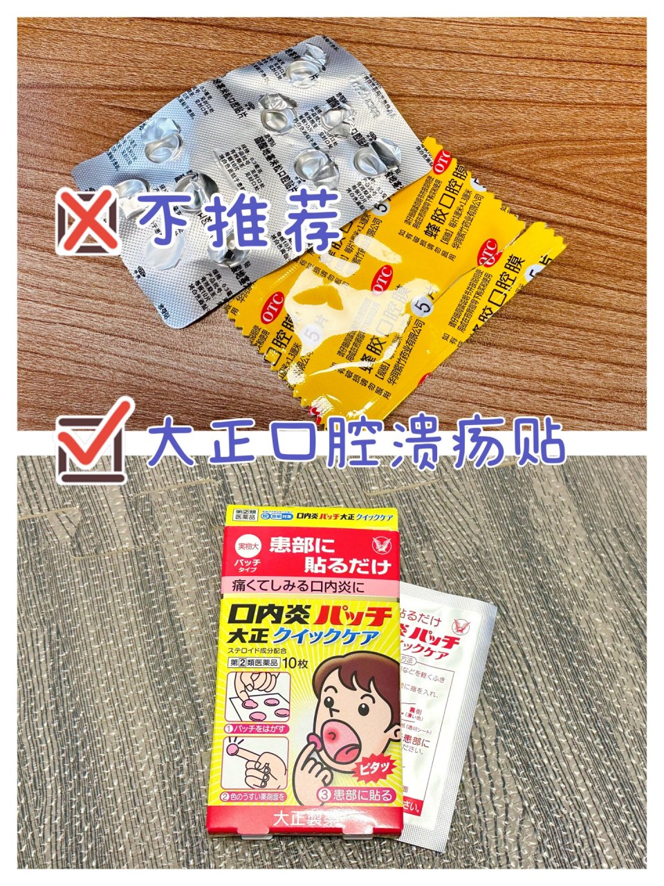 大正口腔溃疡贴 用过醋酸地塞米松口腔贴片,蜂胶口腔膜后才有的比较