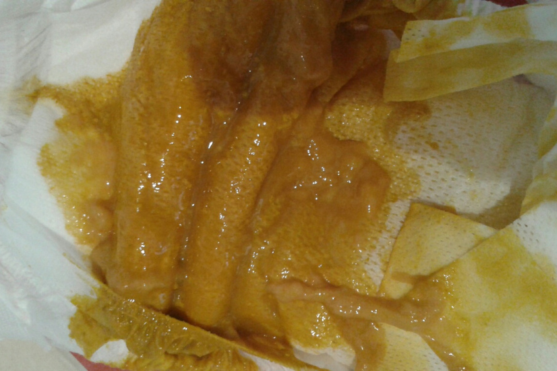 油脂大便较常见,注意饮食减脂肪 宝妈发大便照片咨询宝宝大便情况