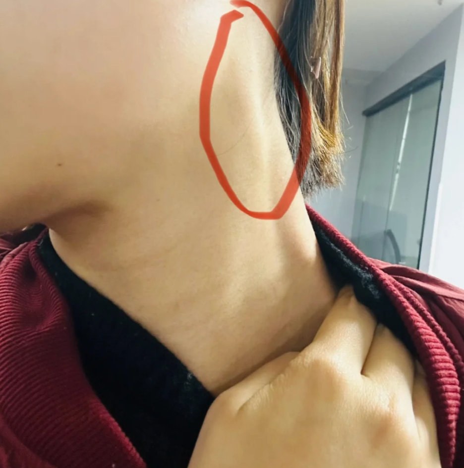 淋巴结肿大多久能好,主要看是什么病引起的