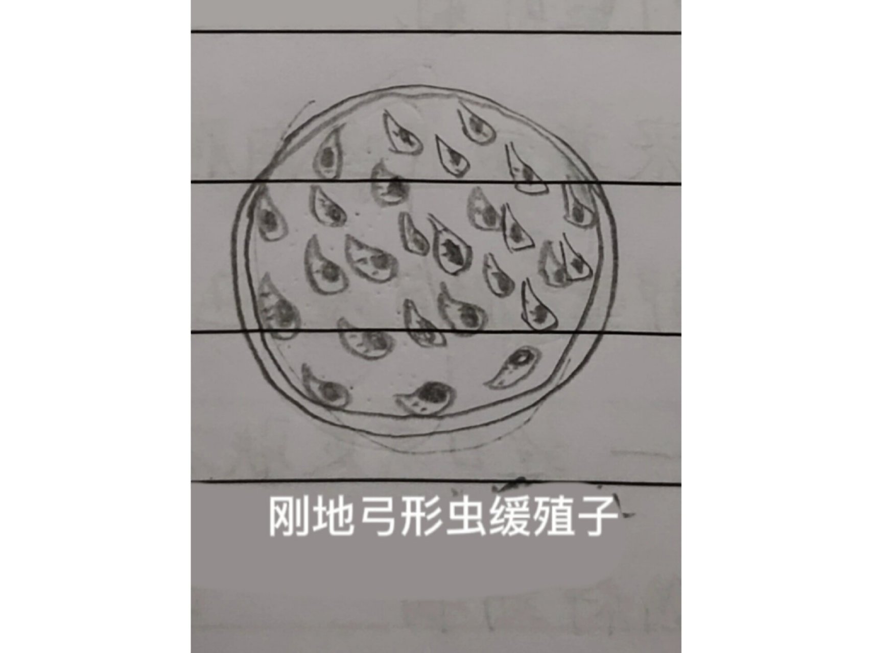 刚地弓形虫速殖子 4.刚地弓形虫缓殖子 5.阴道毛滴虫滋养体