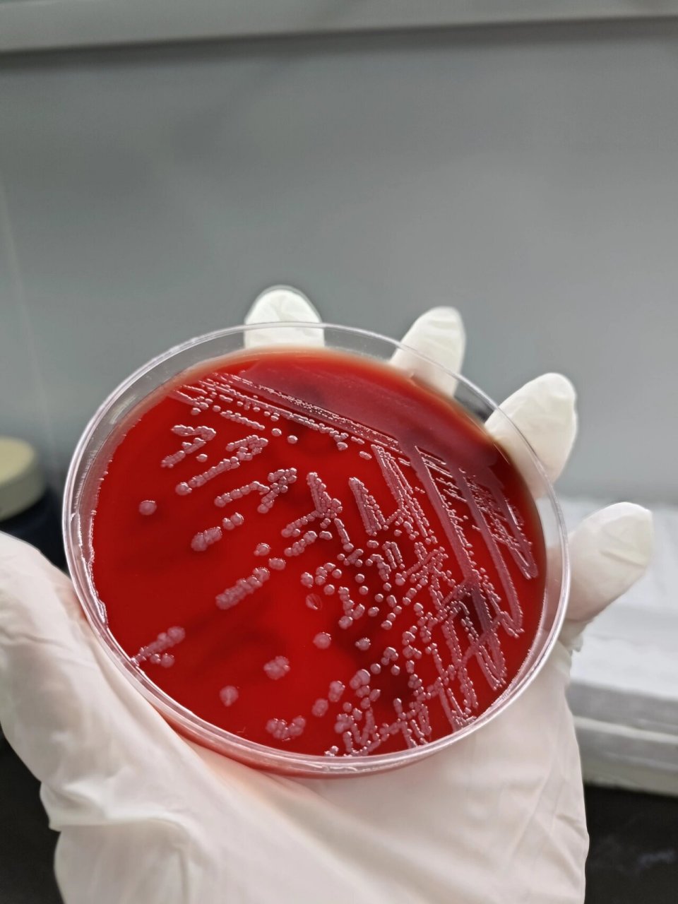 ecl 阴沟肠杆菌 革兰阴性菌 肠道的正常菌群 培养特性 不溶血湿润粘液