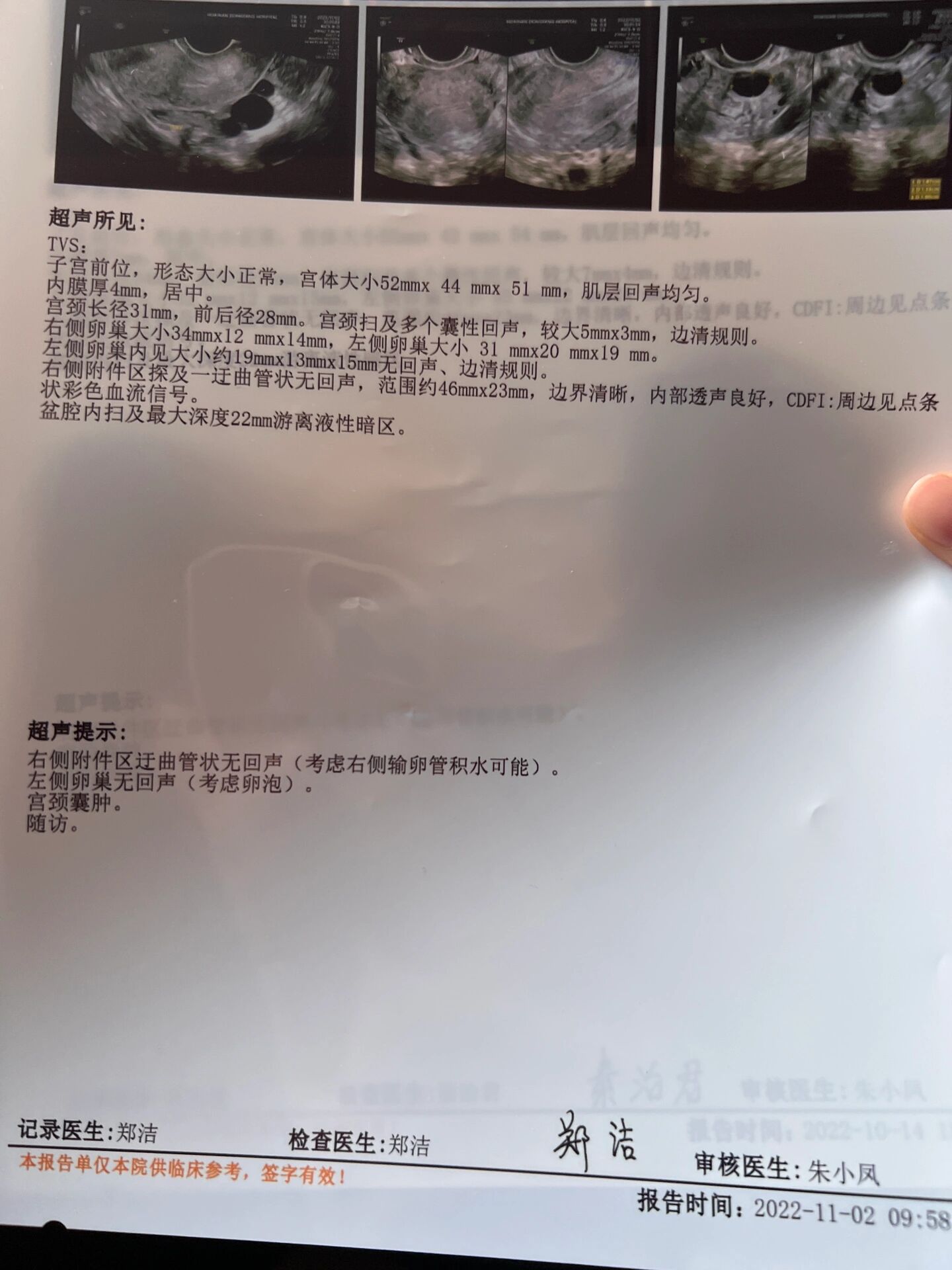 输卵管积水肚子疼