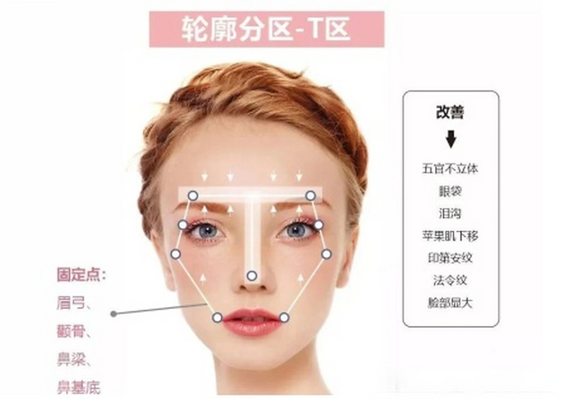 t区轮廓就像我们面部的支架一样,由鼻子,印堂,眉骨组成.
