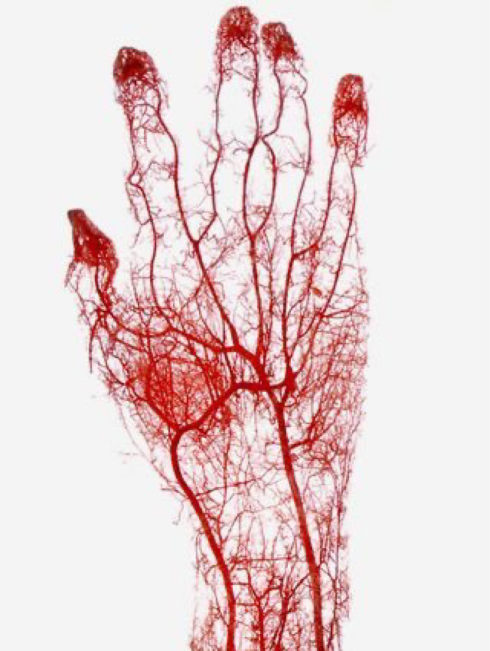 手部血管铸型,看图认动脉