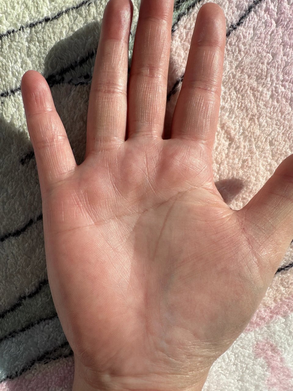 感觉手纹越来越多 有多少人和我一样是通贯掌