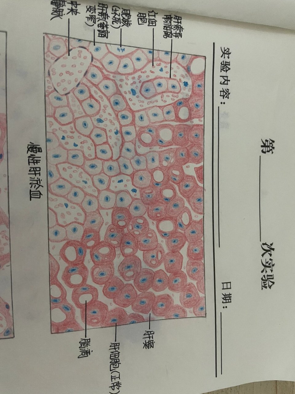 肝淤血大体手绘图图片