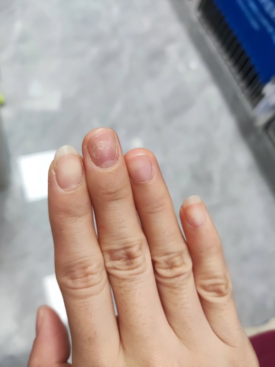 为啥指甲盖突然变的凹凸不平了呀 为啥指甲凹凸不平了呀,不理解,而且