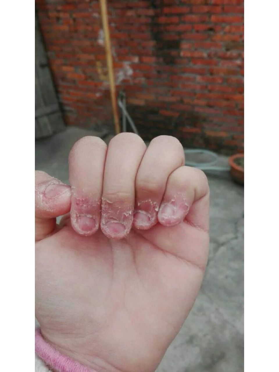 这6个方法可以帮助孩子戒掉咬指甲行为  如何纠正孩子喜欢咬指甲的