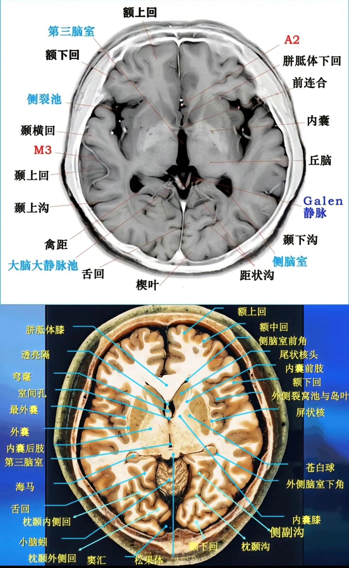 头部横断层解剖图图片