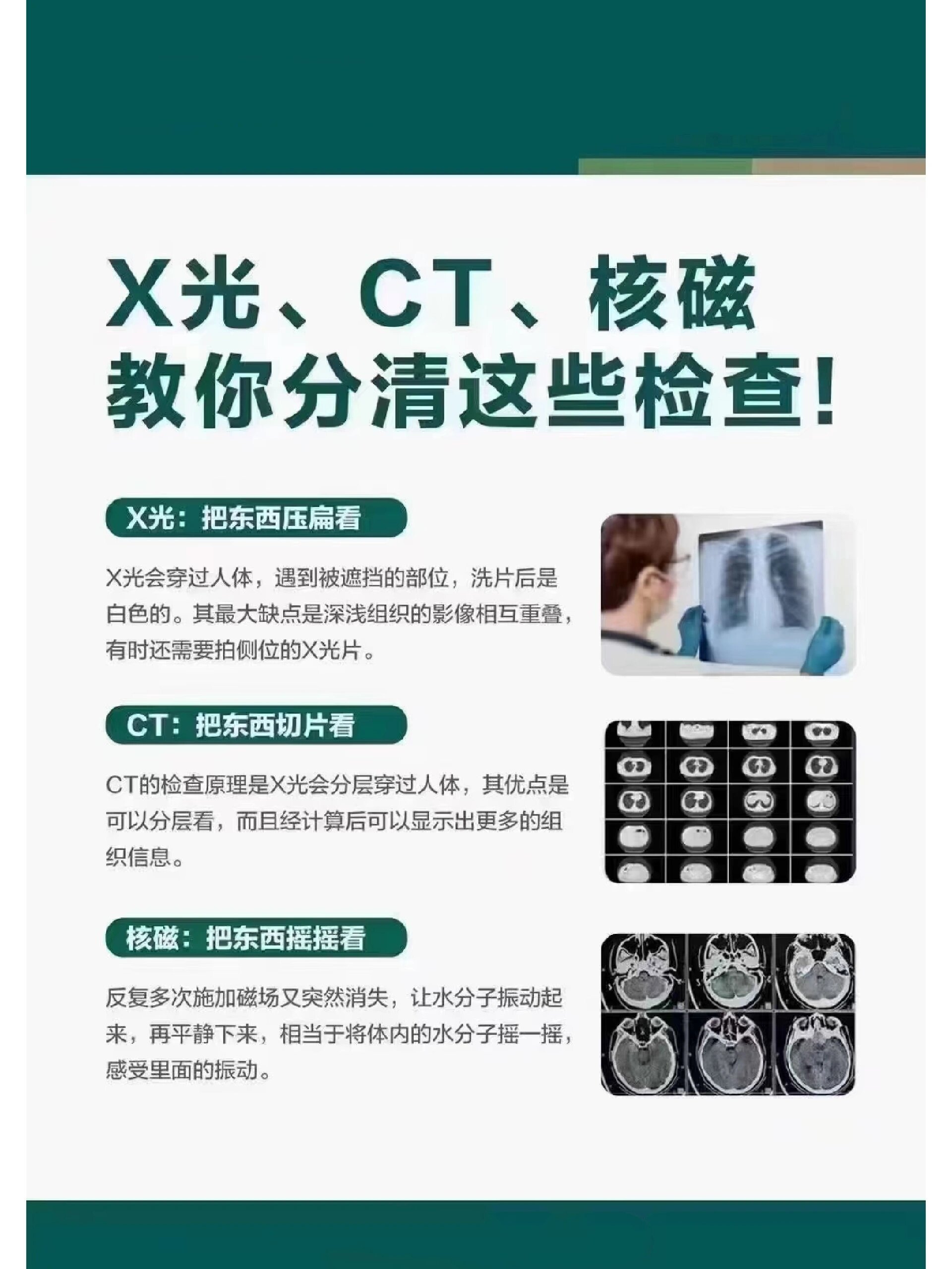 如何区分x光ct和核磁共振 x光,ct,核磁教你分清这些检查!