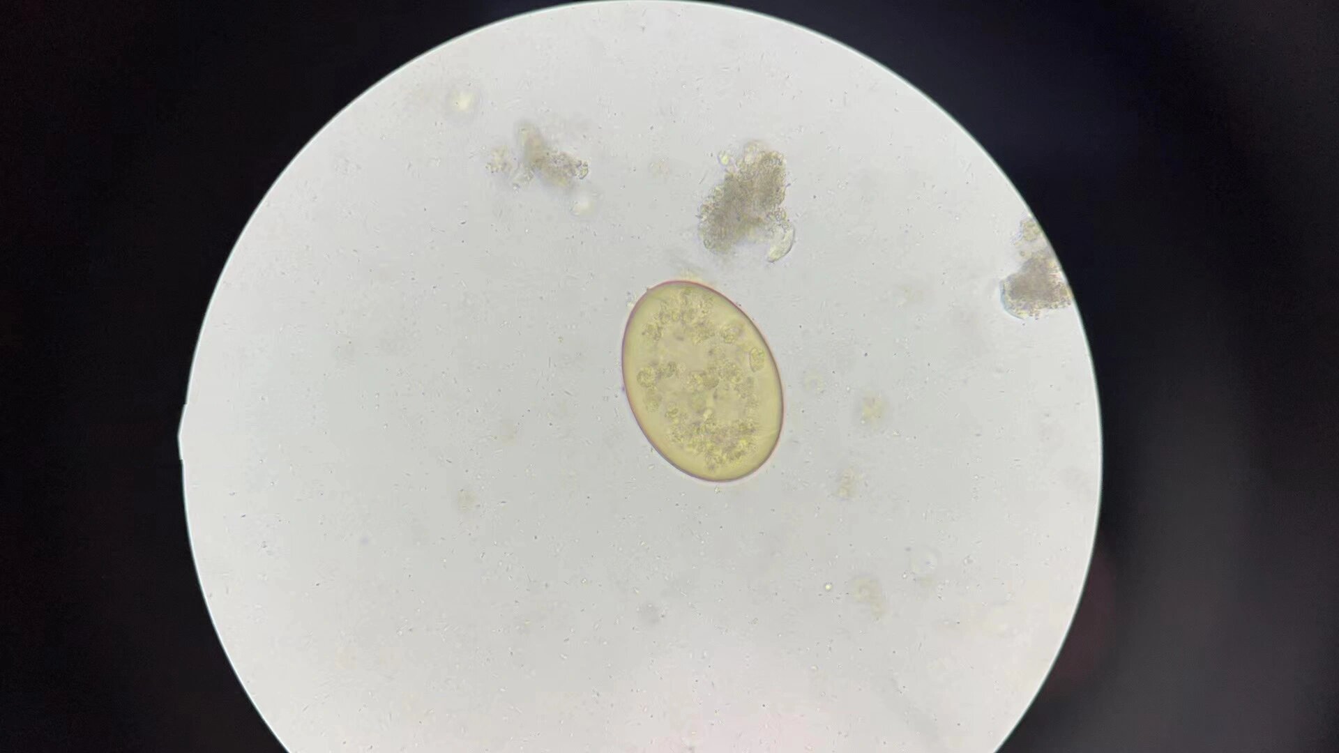 显微镜94——布氏姜片吸虫卵 姜片吸虫感染后寄生于动物小肠,机械性