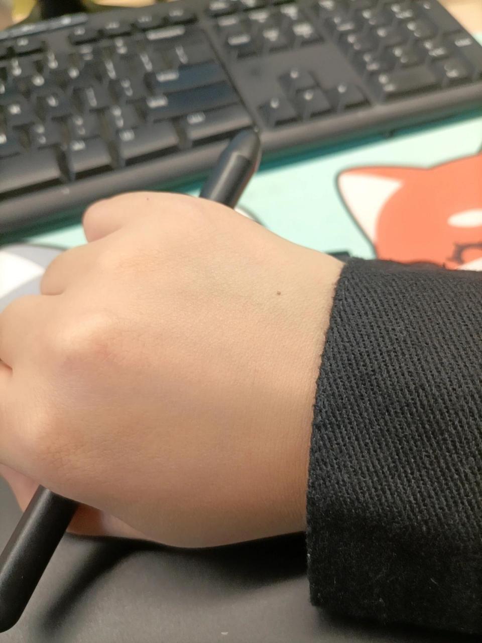 第一种:老辈说,女孩右手上突然长出痣,是遇到了真正爱她的人.