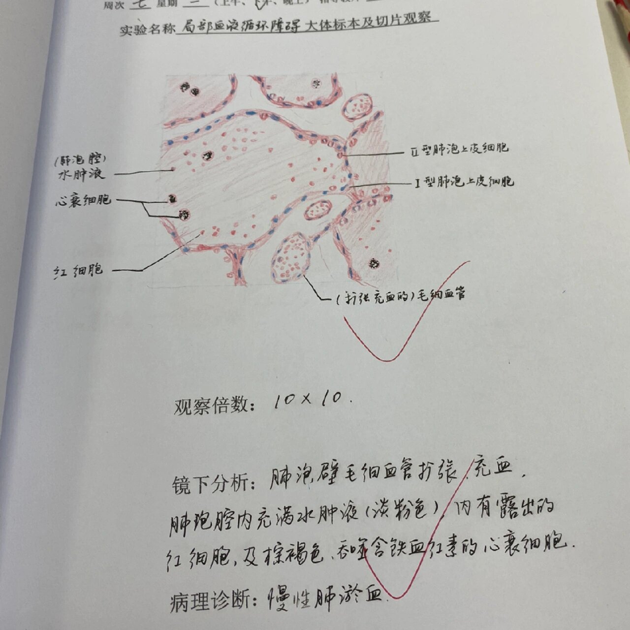 肺淤血镜下图片手绘图片