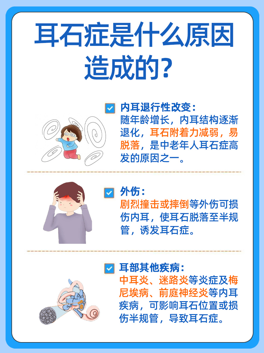 耳石症,正式名称为良性阵发性位置性眩晕,是一种由于内耳半规管中的
