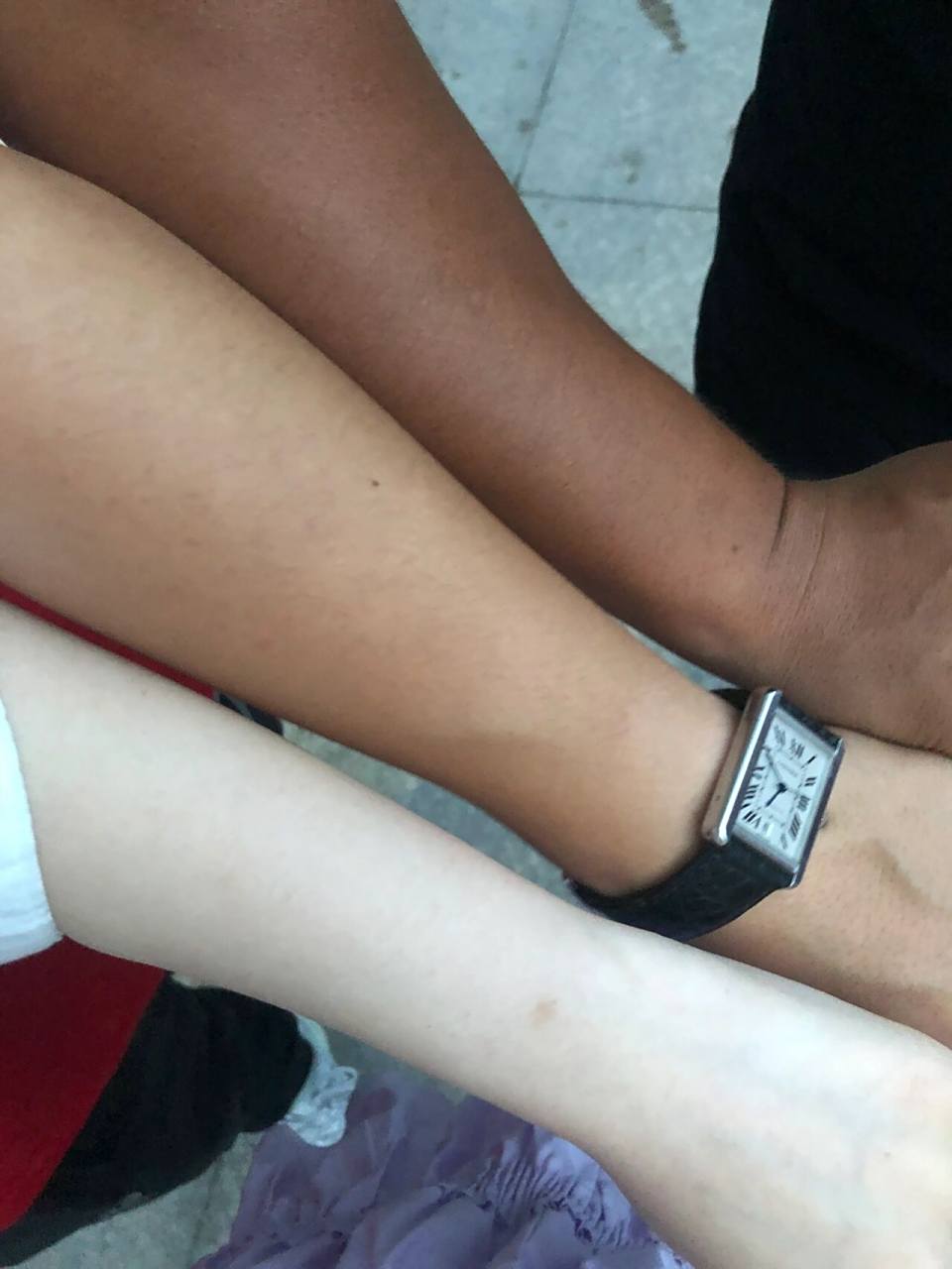 冷白皮和暧白皮怎么分辨呀?