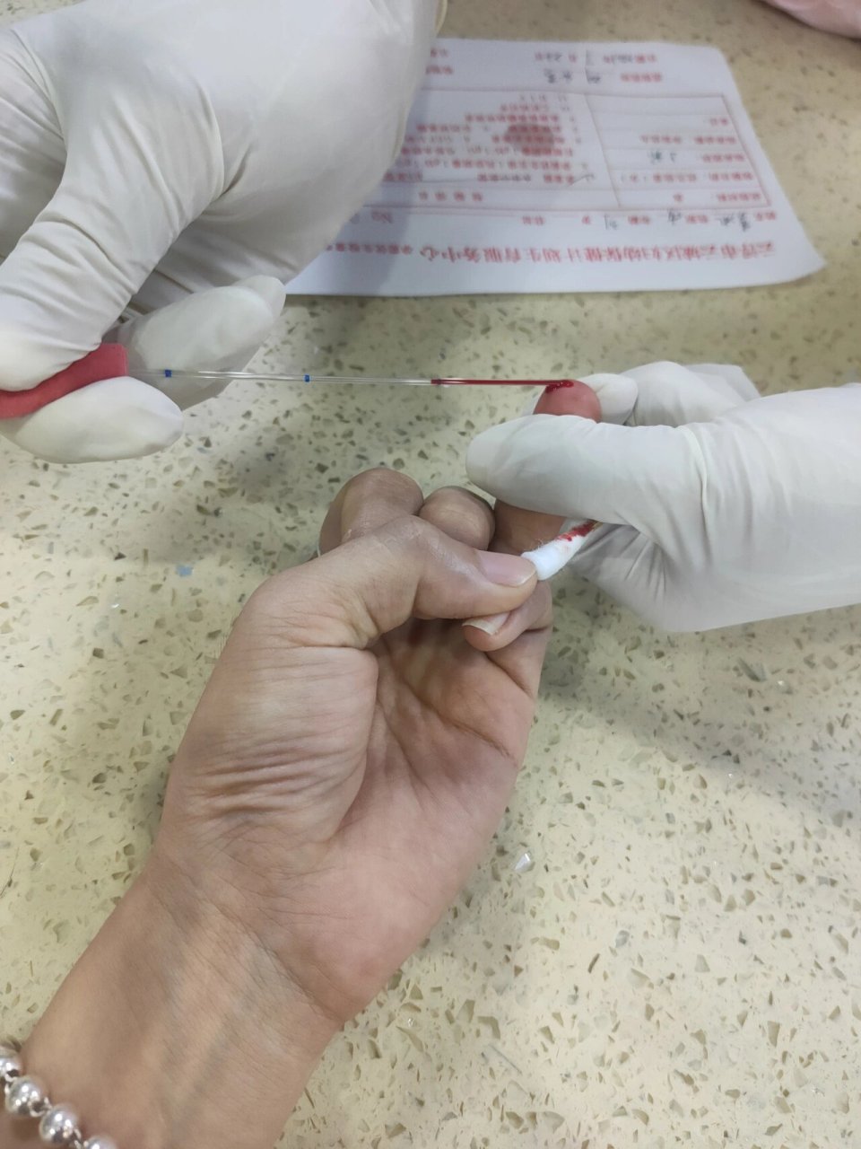 你们都是扎这个手指采血吗?