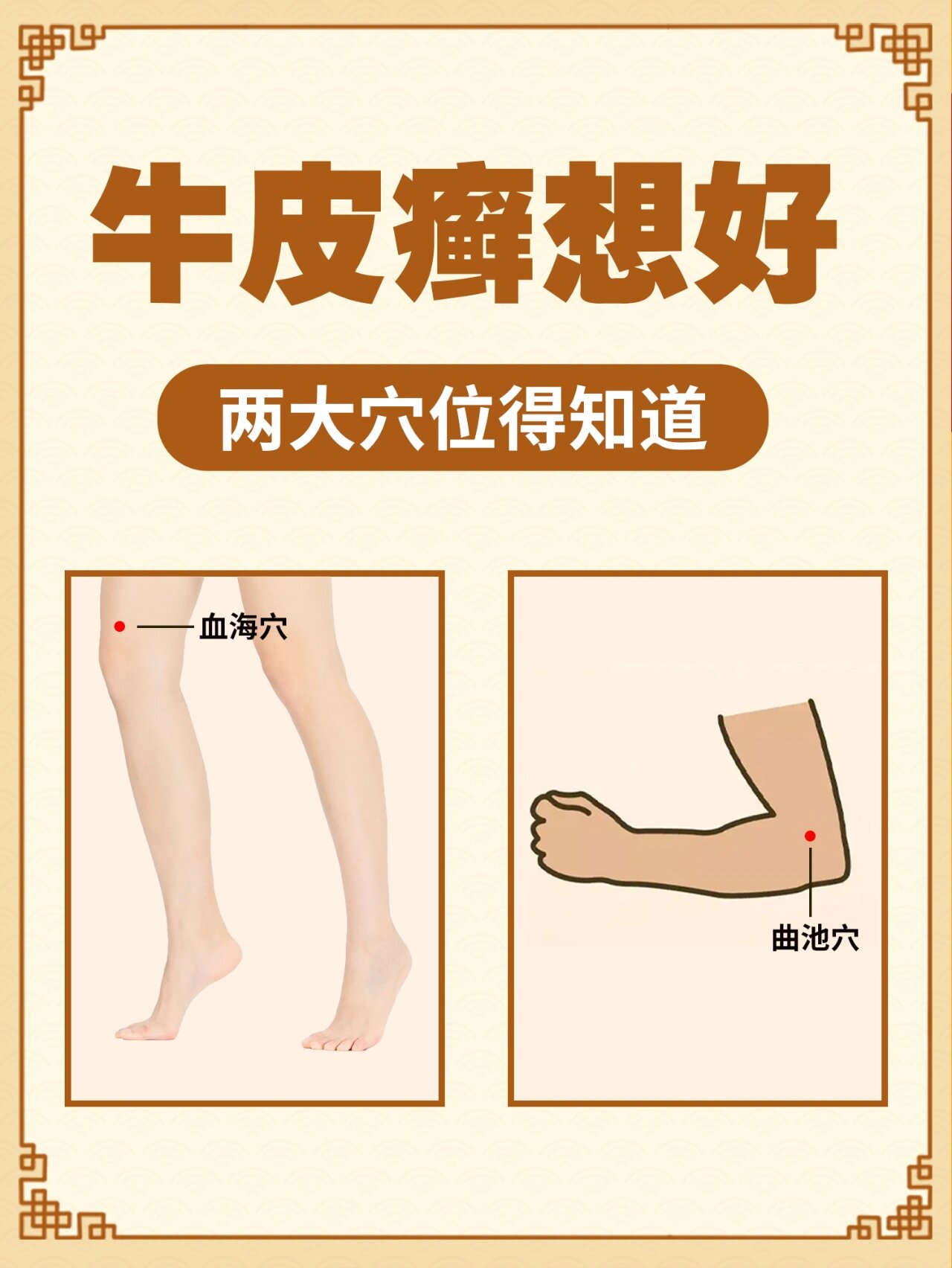 治疗银屑病患者可以按摩曲池穴血海穴和其他的穴位