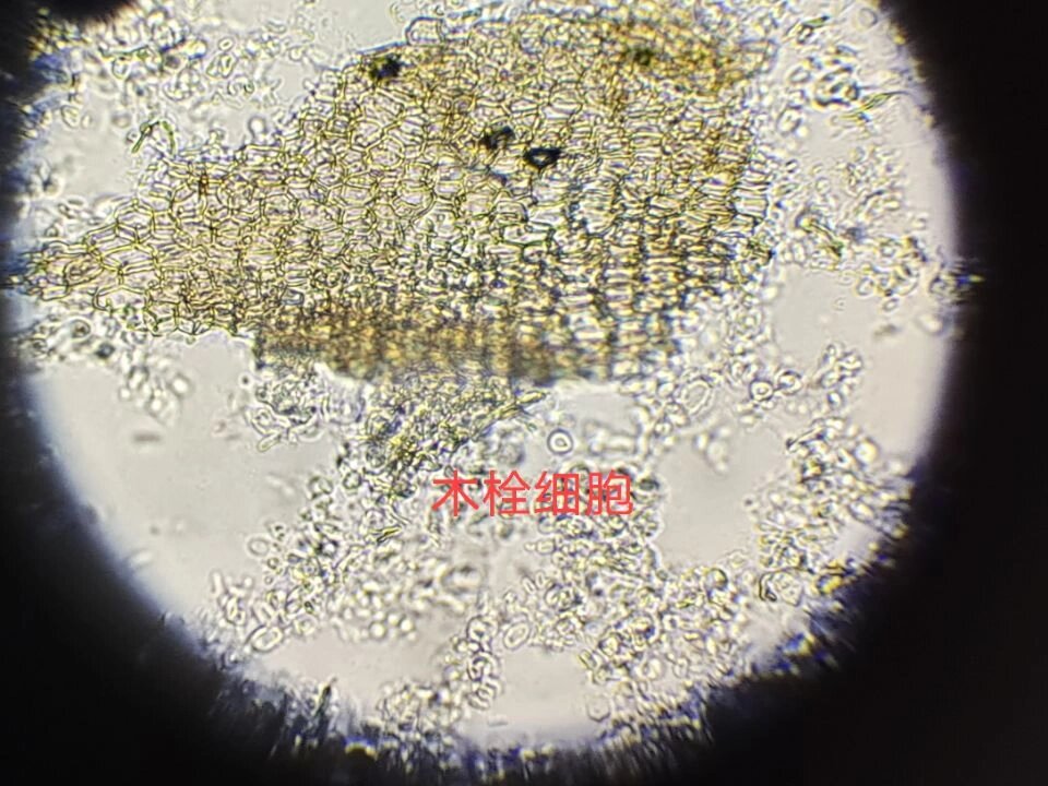 甘草根横切面 显微图片