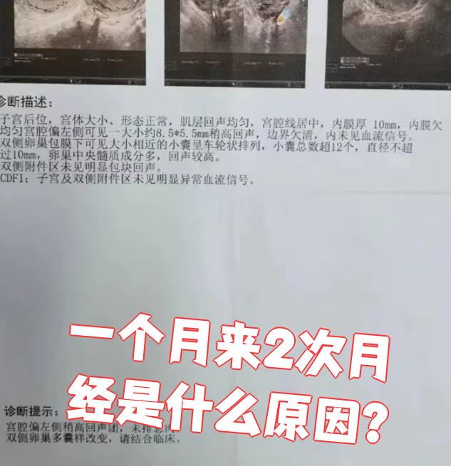 为什么大姨妈一个月来2次就不来了为什么在线