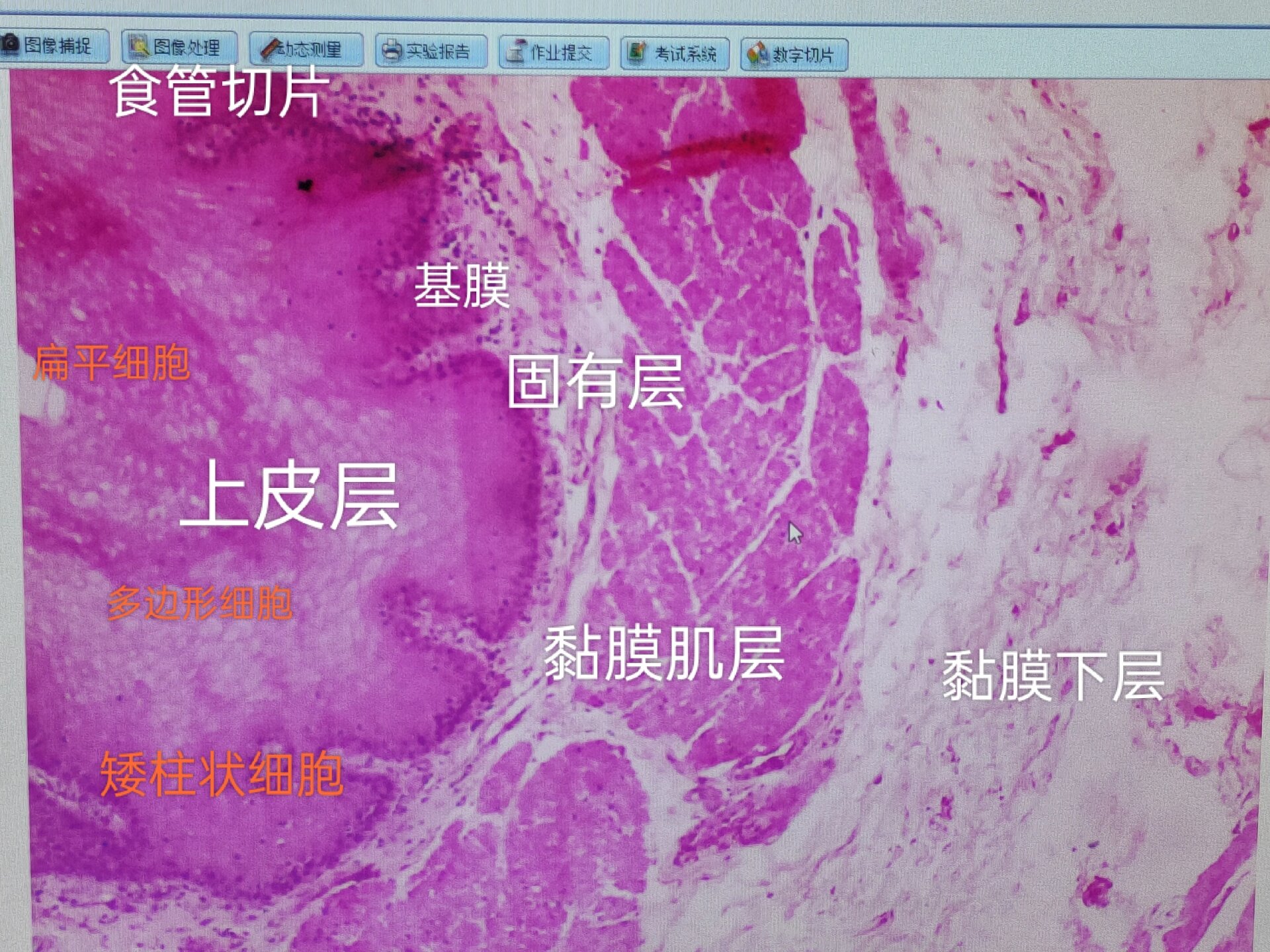 单层柱状上皮&复层扁平上皮实验笔记