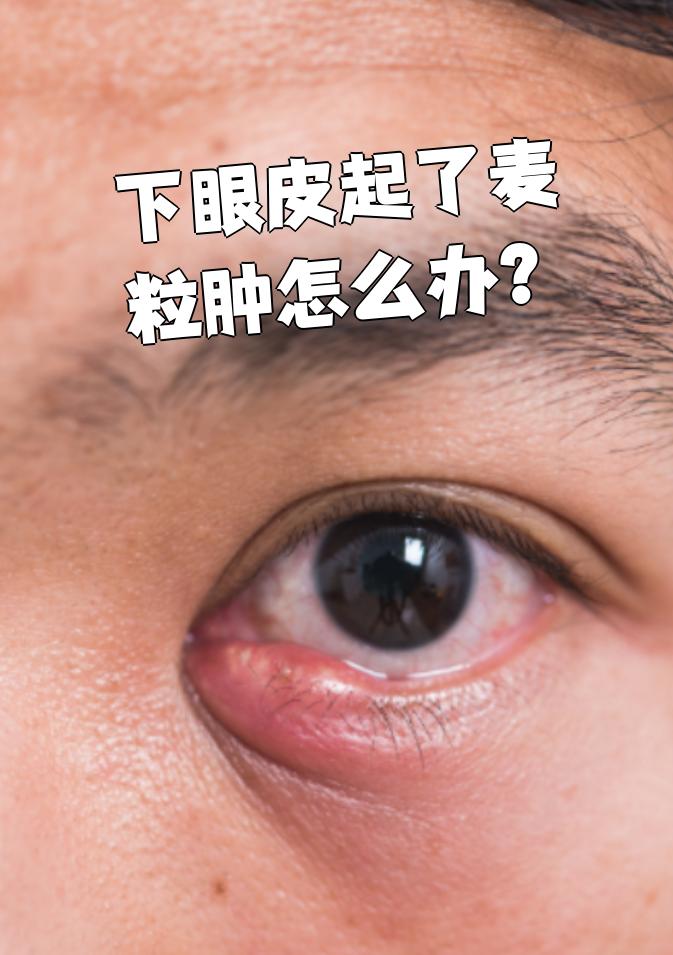 主要症状是眼皮红肿,发热,摸起来有硬块,一碰就疼