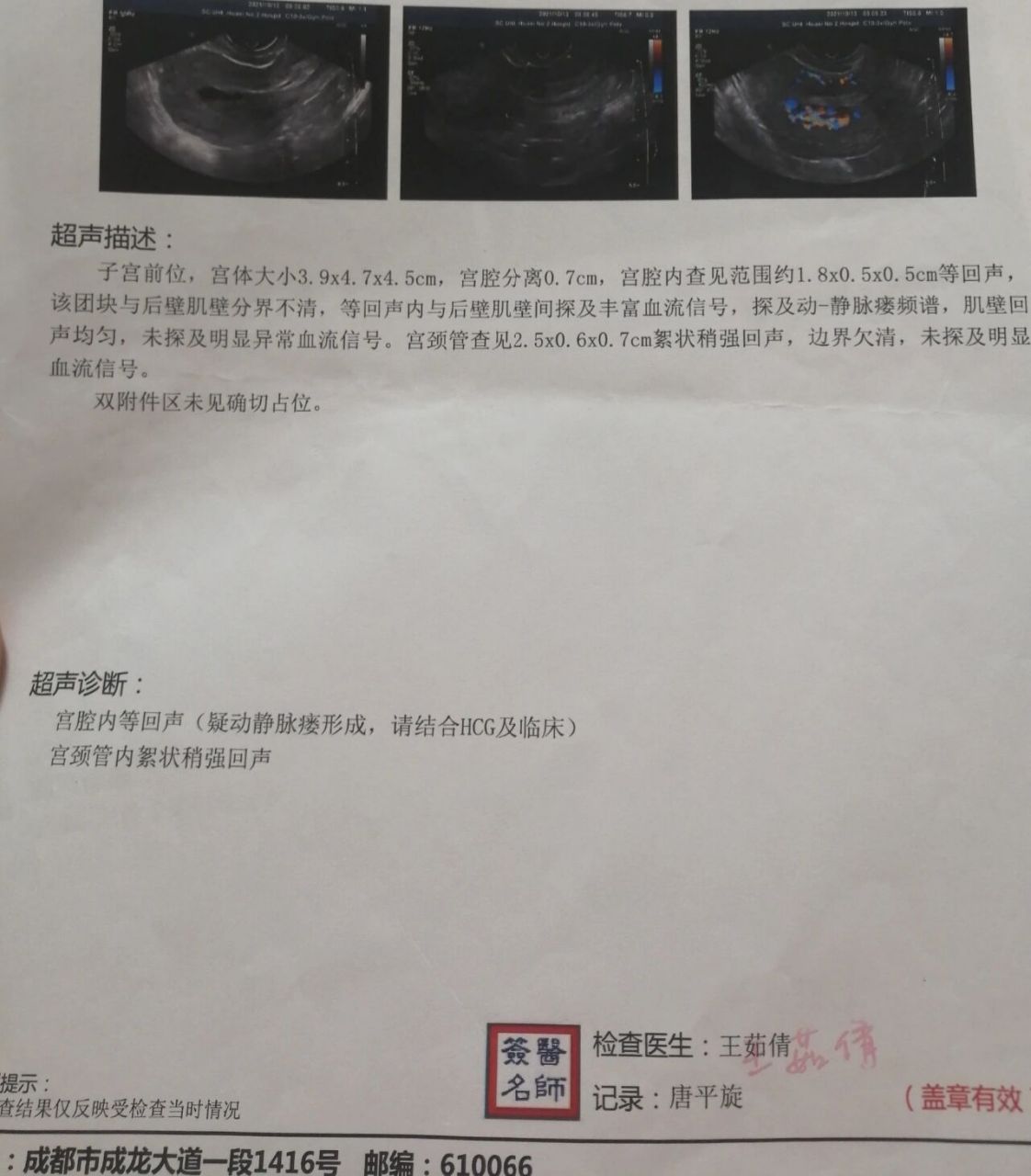 子宫动静脉瘘超声报告图片