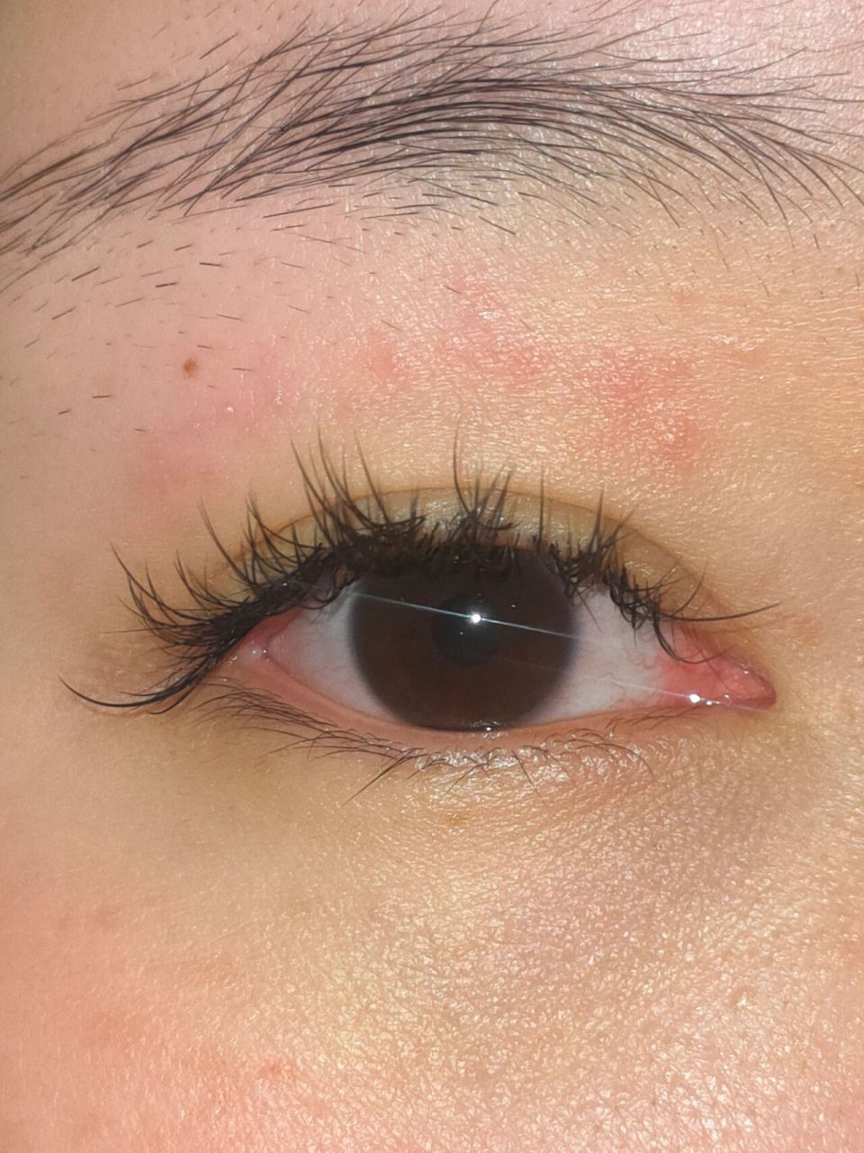 突然泛红 有没有谁能告诉我为什么眼皮突然会敏敏呀