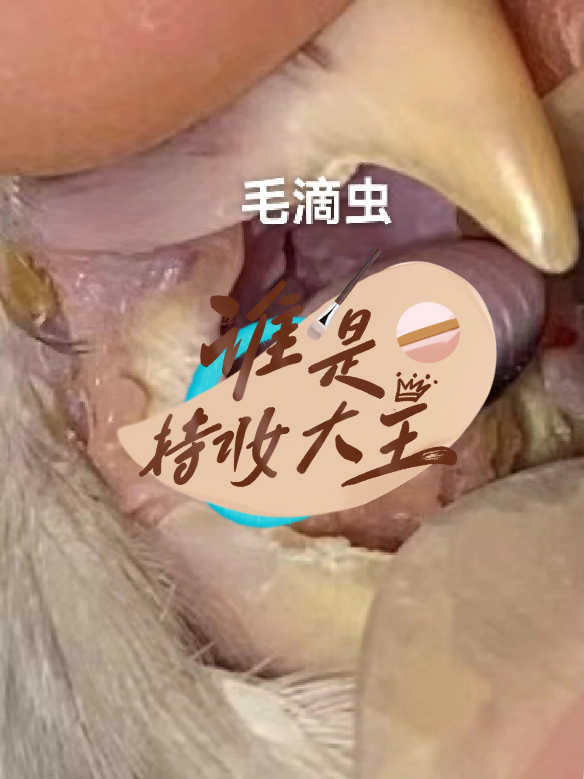 毛滴虫,每月来体检来喷嘴巴