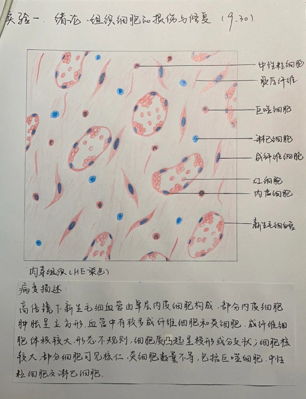 肉芽组织手绘图片