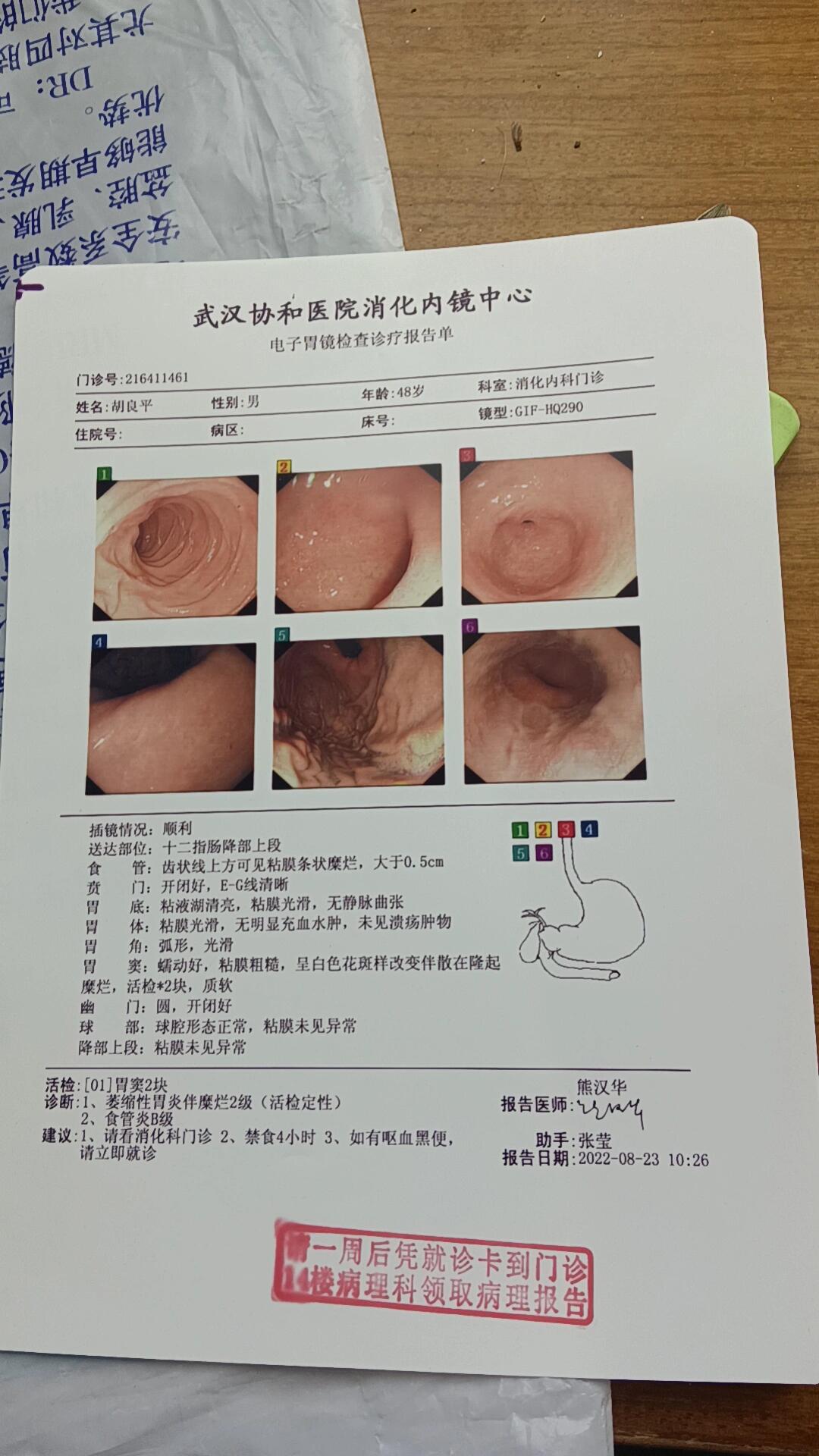 有姐妹帮我看看这个萎缩性胃炎伴糜烂有肠化么?