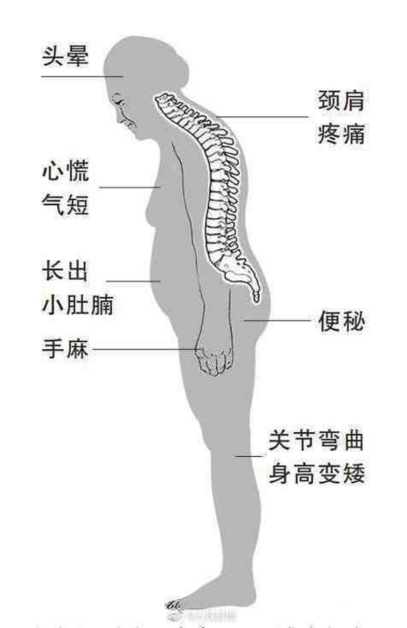 【#4个动作纠正探颈#】"探颈"通常是因为脖子,背部,胸部等部位肌肉有