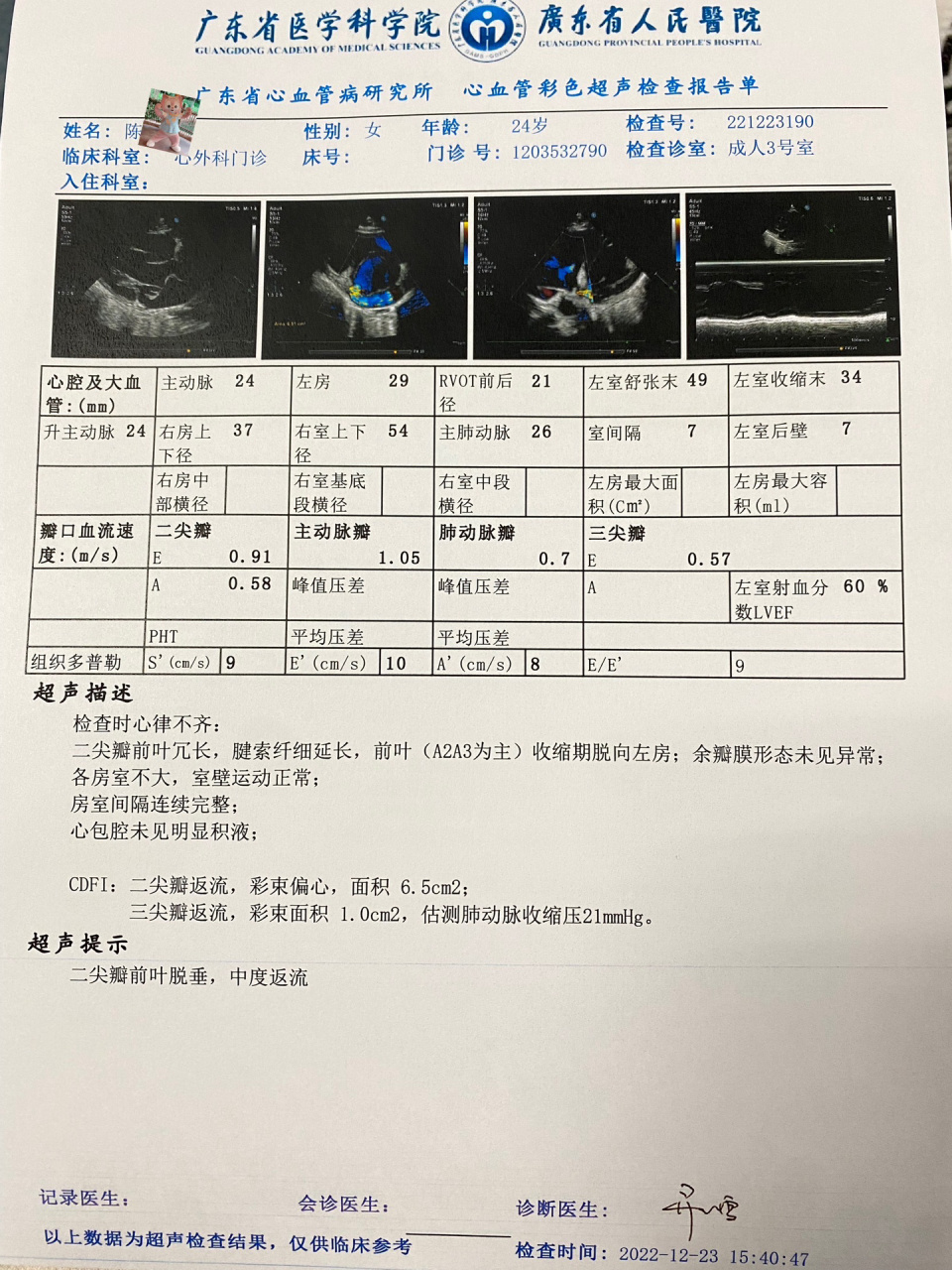 二尖瓣返流广东省心研所问诊分享(更新版 去年十月有天突然晕厥去医院