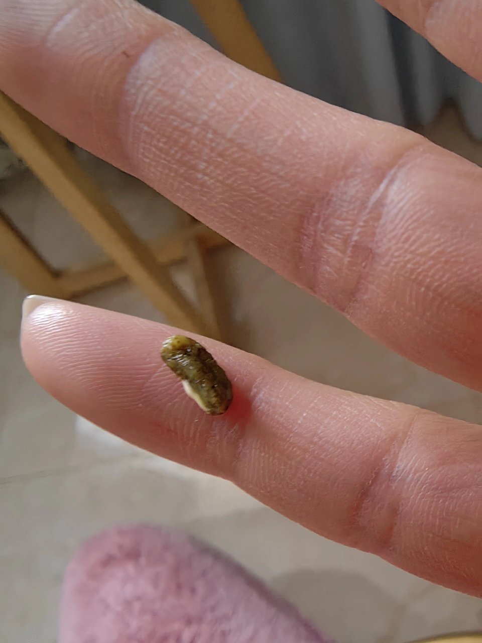 屎黏着,而且它拉出来的便便里面看起来总是有杂质,不知道是生什么病了