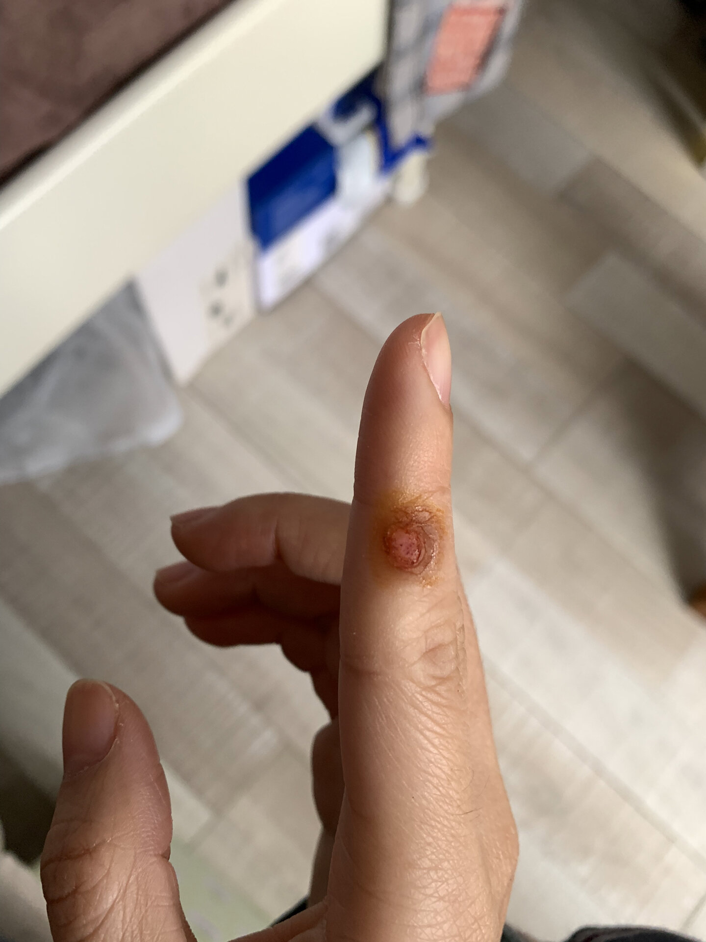 更新已痊愈 1,一开始没注意,扣过没好还大了