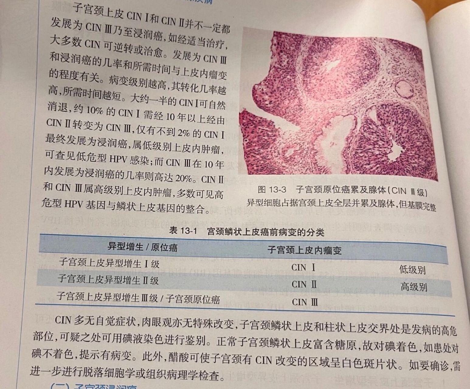 书本知识科普——宫颈原位癌 这个是我在我弟弟的医学课本上看到的