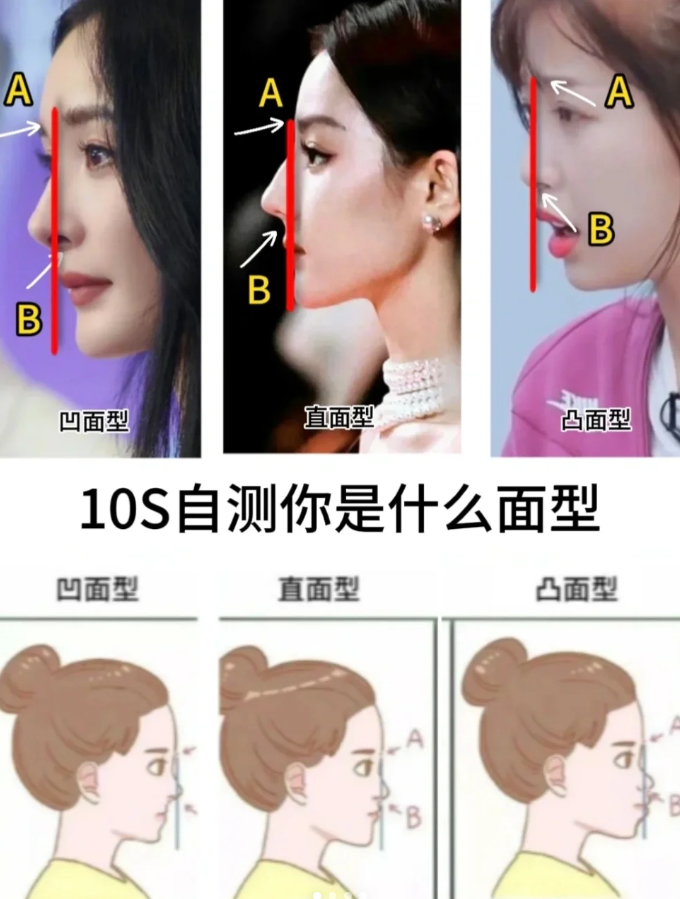 通过几张明星的图片来看看,直面型,凸面型和凹面型.
