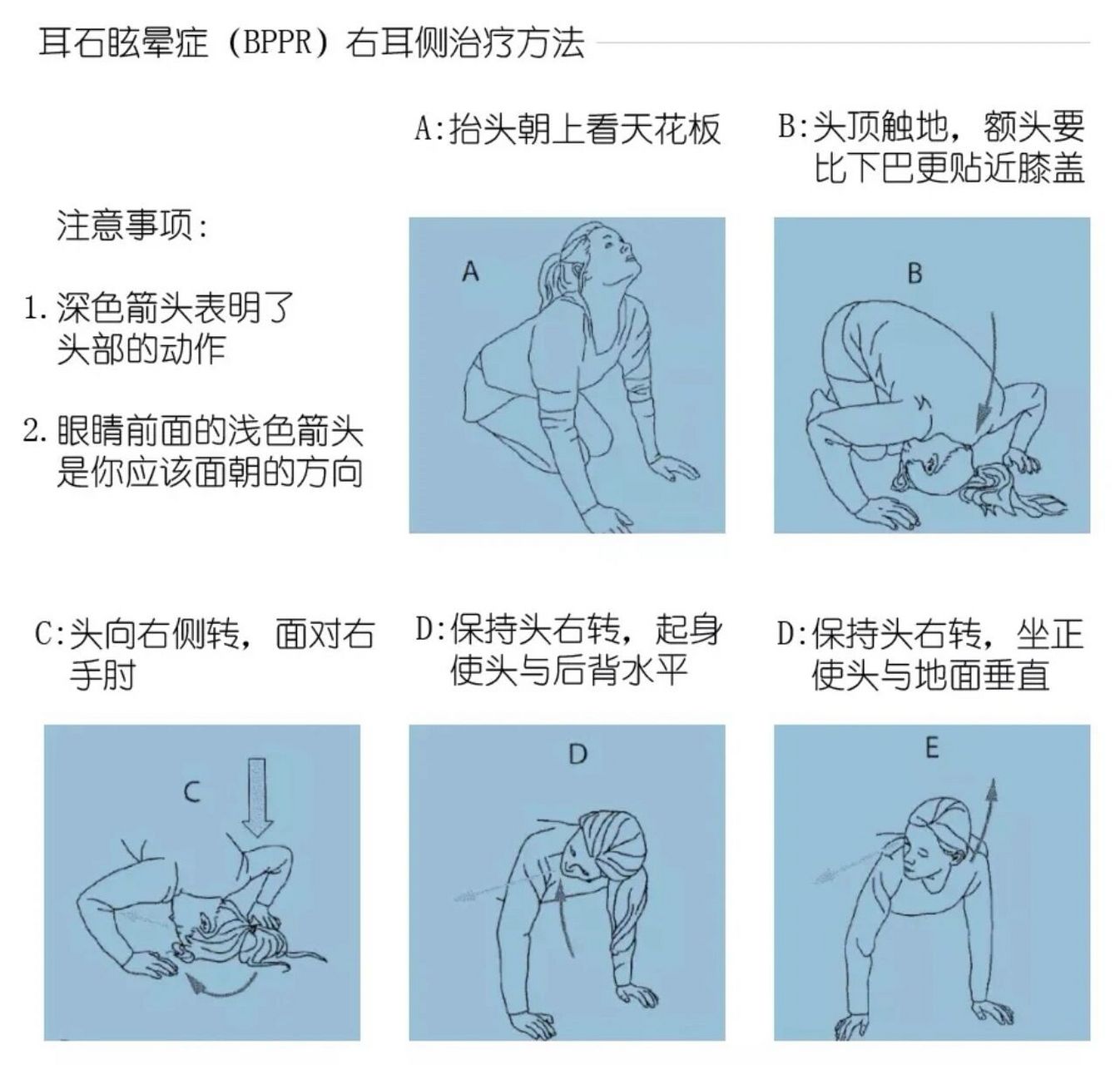 今天想给大家聊一聊我耳石症一周后完全复位的情况!