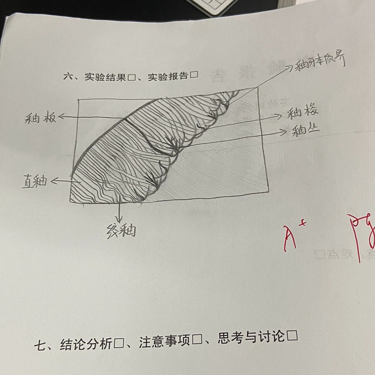 釉牙本质界绘图图片