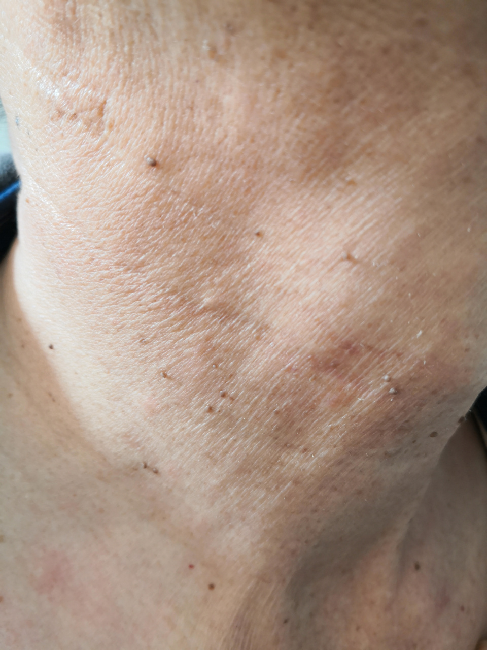 皮赘##解决皮肤问题专注皮肤美容##纪秀军皮肤科专家的访谈