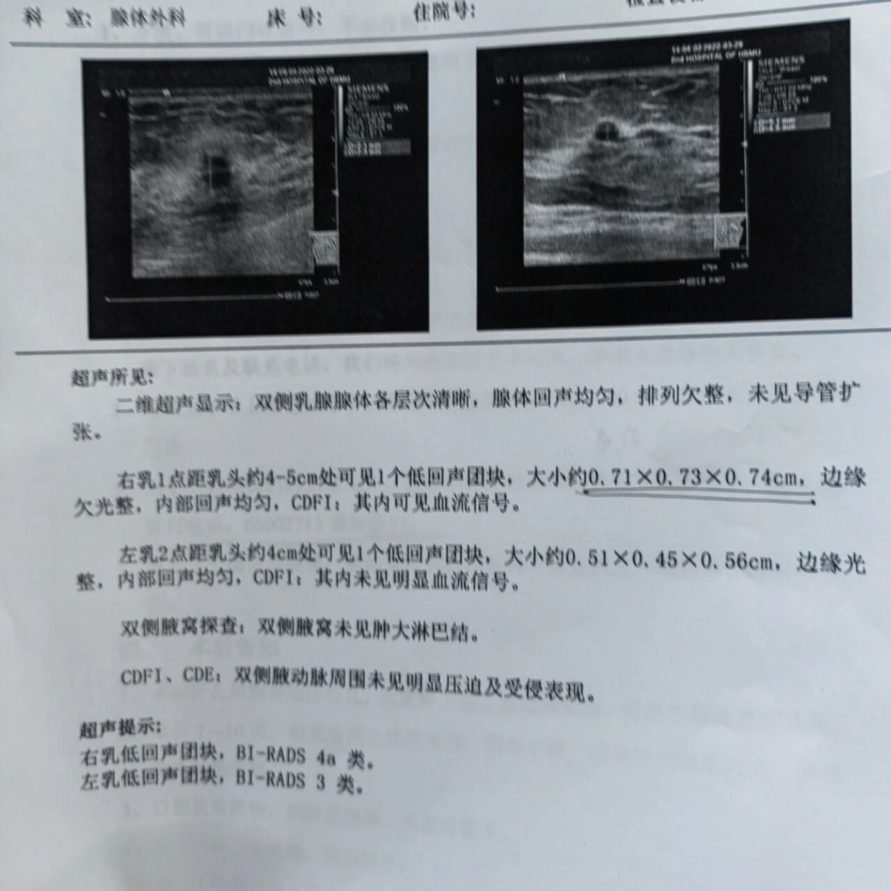 乳腺结节4a,必须要手术吗 上个月去市中医院查出来乳腺结节有一个4a