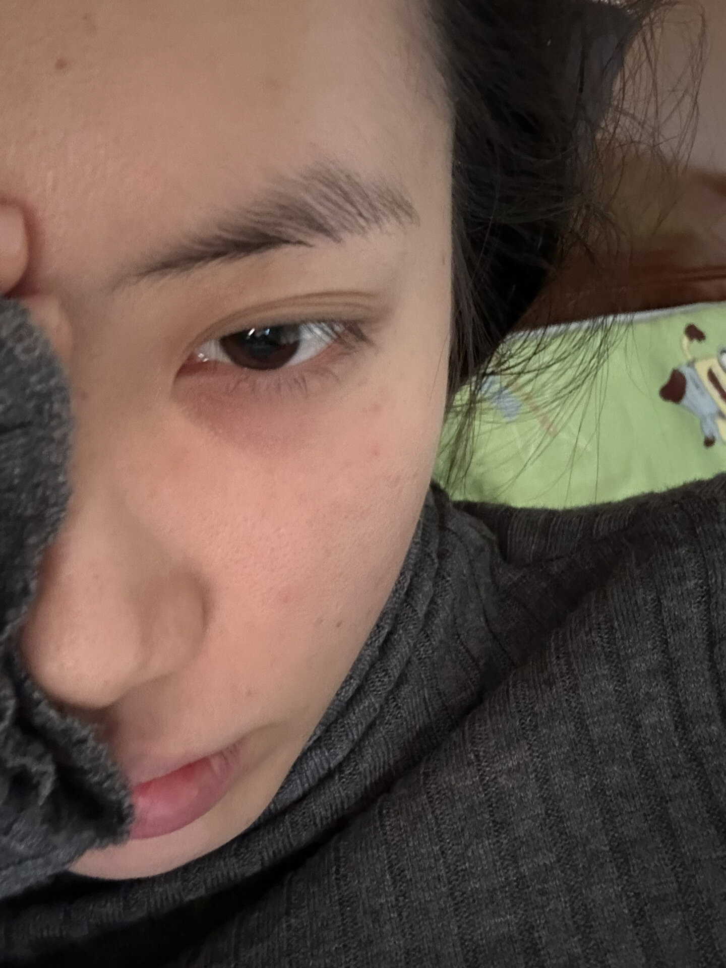 脸看起来很脏 有什么办法拯救吗