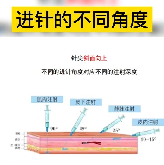 不同的进针角度对应不同的注射深度哦