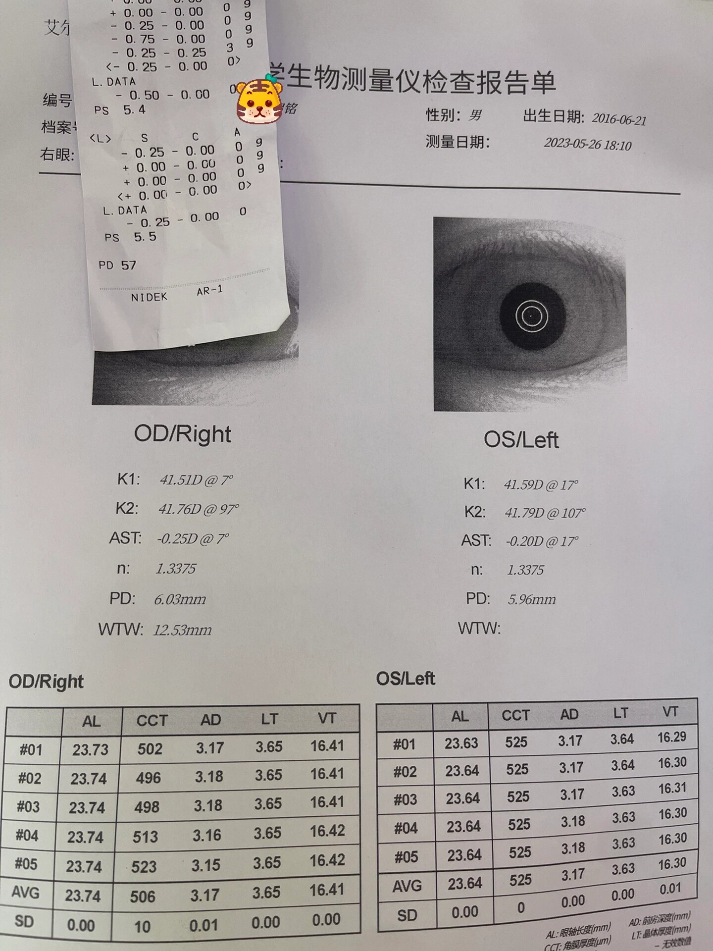 艾尔兴哺光仪 失明图片