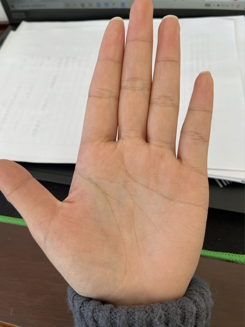 两个手掌掌纹,右手中间怎么断了. 右手掌中间那条线是断的么?