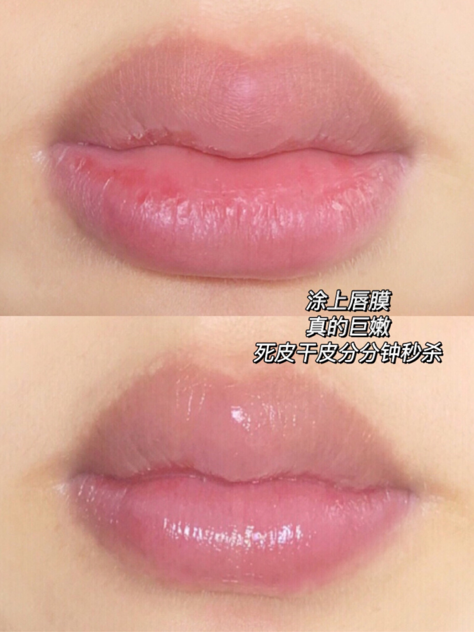 冬天嘴巴92总是干干的 我手也欠总喜欢扣嘴上的