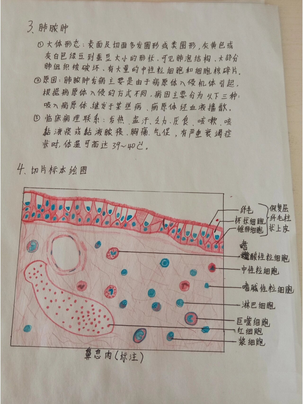 肠伤寒红蓝铅笔图图片